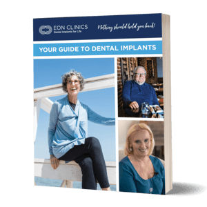 Ebook guide to dental implants