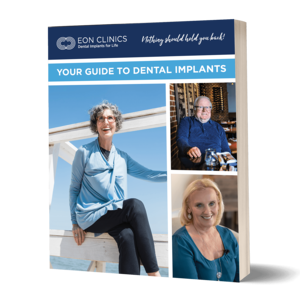 Ebook guide to dental implants