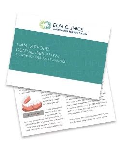 eBook on implants for teeth replacement cost