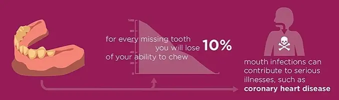 Weighing Cost of Tooth Decay Treatment
