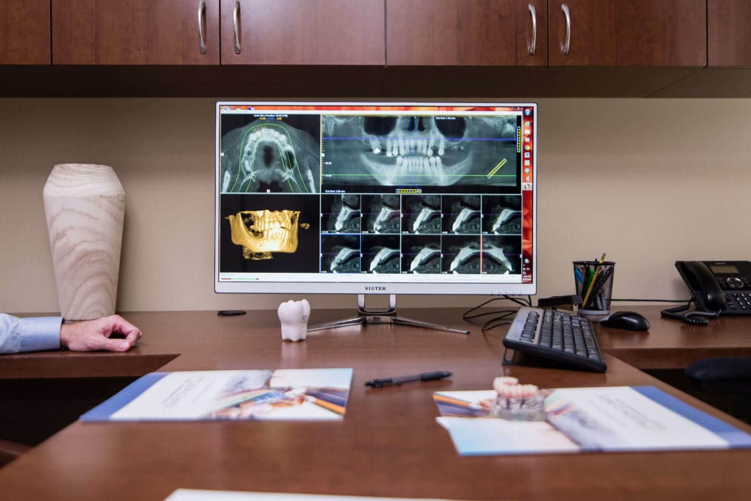 Dental CT Scanner Technology