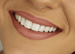 Tips to whiten the teeth